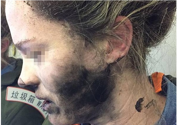 ESPLODONO LE CUFFIE MENTRE DORME IN AEREO E LE DEVASTANO IL VOLTO: ECCO A COSA DOVETE ASSOLUTAMENTE FARE ATTENZIONE - 15/03/2017