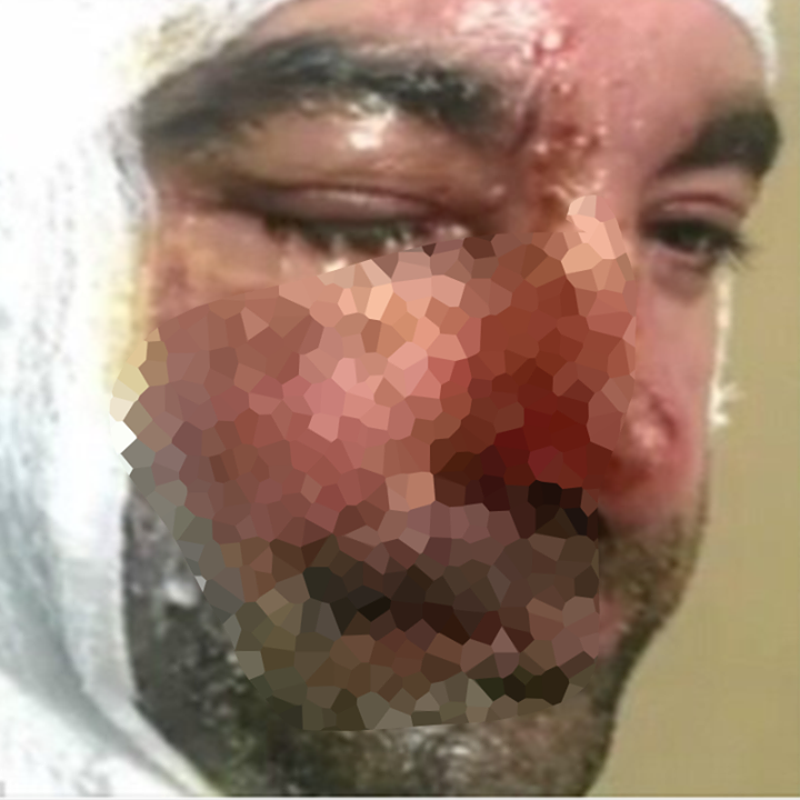 UN OGGETTO CHE MOLTI USANO TUTTI I GIORNI LO HA RIDOTTO COSI': LA FOTO SHOCK SUL WEB - SCATTA L'ALLARME - 07/03/2017