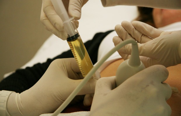 ARRIVA LA NUOVA AMNIOCENTESI: PUO' DIAGNOSTICARE FINO ALL'80% DELLE MALATTIE - 28/12/2014
