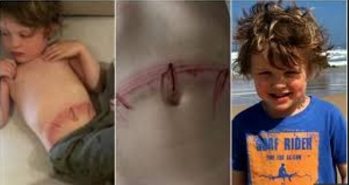 ''GLI STAVO FACENDO IL BAGNO, POI...TREMENDO'' IL DRAMMA, POI L'ASSURDA VERITA': MAMME STATE ATTENTE PUO' CAPITARE ANCHE AI VOSTRI FIGLI - 21/06/2016