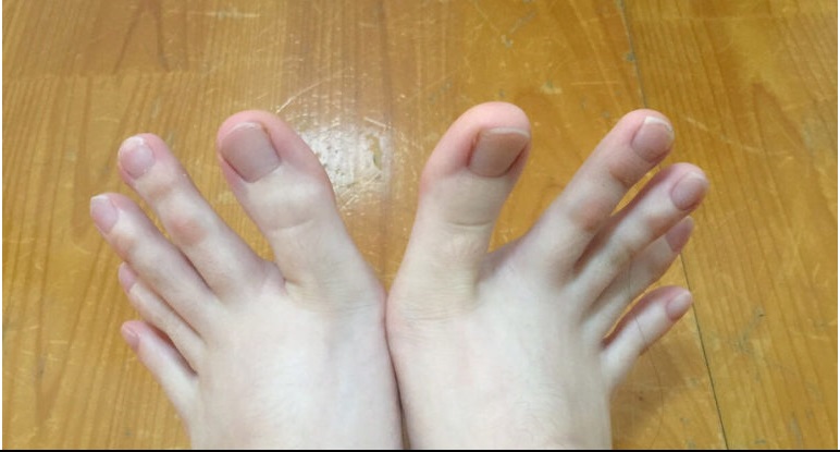 LE DITA DEI PIEDI DI QUESTA RAGAZZA STANNO FACENDO IMPAZZIRE IL WEB - 23/06/2016