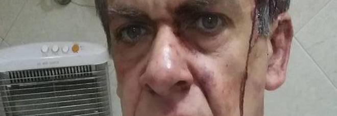 LUIGI ACCOLTELLA IL LADRO NELLA PIZZERIA, POI PUBBLICA LE FOTO E IL SELFIE SPORCO DI SANGUE SU FB - 23/06/2016