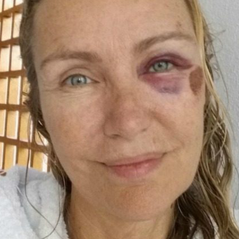 INCIDENTE PER LICIA COLO': ECCO COSA LE E' SUCCESSO - 30/05/2017