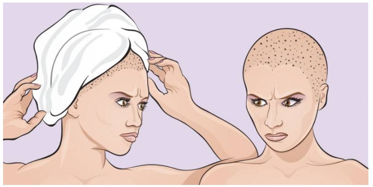 ANCHE TU HAI L'ABITUDINE DI AVVOLGERE I CAPELLI NELL'ASCIUGAMANO DOPO LA DOCCIA? ECCO PERCHE' NON DOVRESTI FARLO PIU'... - 04/06/2017
