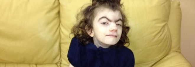 MARTINA, DONNA-BAMBINA, RESPINTA DAGLI OSPEDALI: TAM TAM SUL WEB PER SALVARLA - 14/01/2014