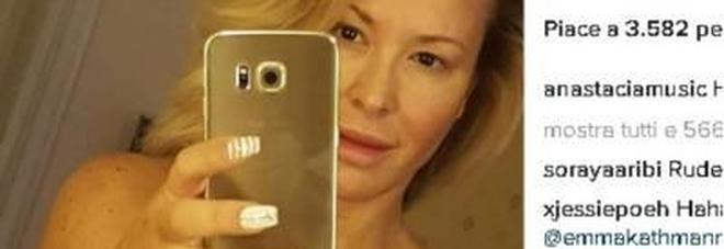 ANASTACIA IN TOPLESS, LA CANTANTE MOSTRA FIERA IL SUO CORPO DOPO IL CANCRO AL SENO - 28/06/2016
