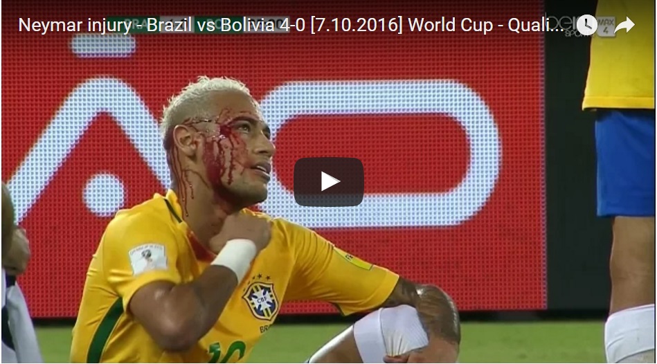 ''FAMMI UN TUNNEL E TI SPACCO LA FACCIA'' SHOCK IN BRASILE - ECCO COS'HA COMBINATO NEYMAR - VIDEO - 10/10/2016