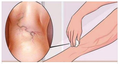 DITE ADDIO PER SEMPRE ALLE SMAGLIATURE: BASTA UN COMUNE INGREDIENTE E SPARIRANNO COME PER MAGIA - 02/02/2017