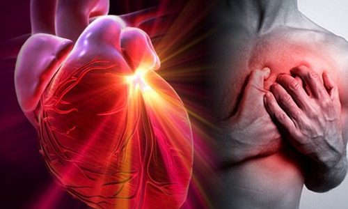 SCOPERTA SHOCK: I CAPELLI AVVERTONO DI UN INFARTO UN MESE PRIMA. ECCO COSA VERIFICARE - 19/02/2017