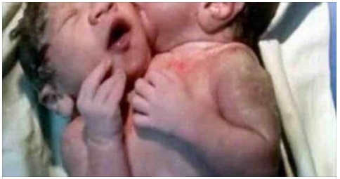 IL PARTO E' SCONVOLGENTE, MAMMA DISPERATA ''DITEMI CHE NON E' VERO'' - 08/03/2017