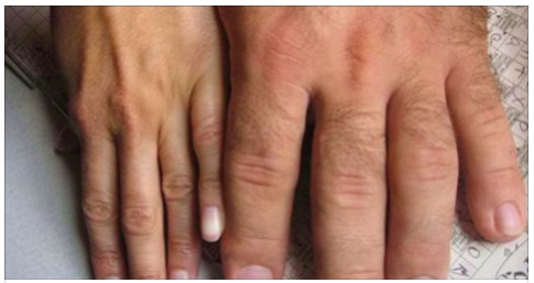 COME SONO LE DITA DELLA TUA MANO? ECCO COSA RIVELANO SULLA TUA VITA SESSUALE - 16/03/2017
