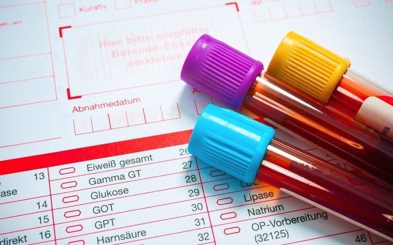 OMOCISTEINA: L'ESAME CHE I MEDICI NON PRESCRIVONO MAI. ECCO PERCHE' - 06/06/2017