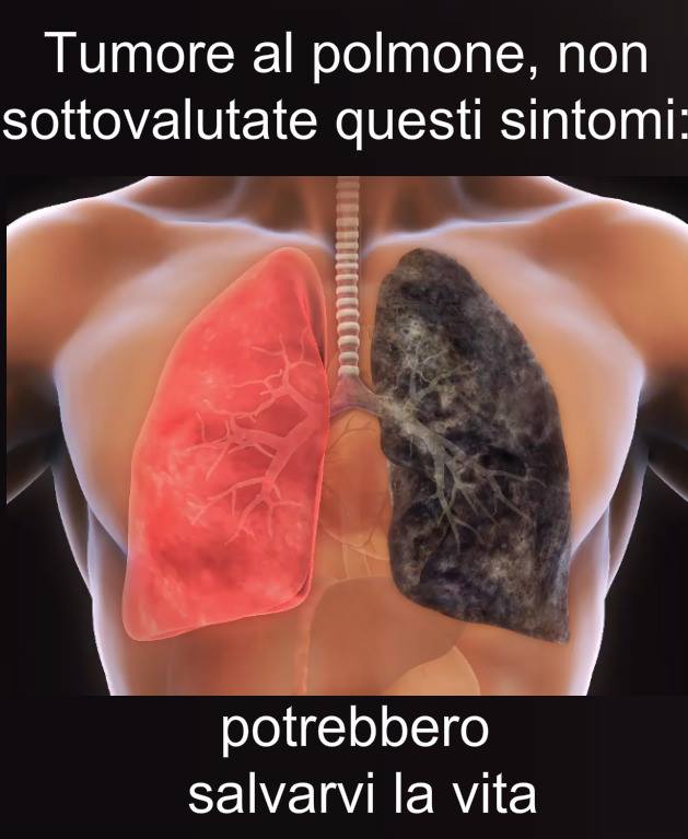 TUMORE AL POLMONE: NON SOTTOVALUTARE QUESTI SINTOMI - POTREBBERO SALVARTI LA VITA - 17/11/2017