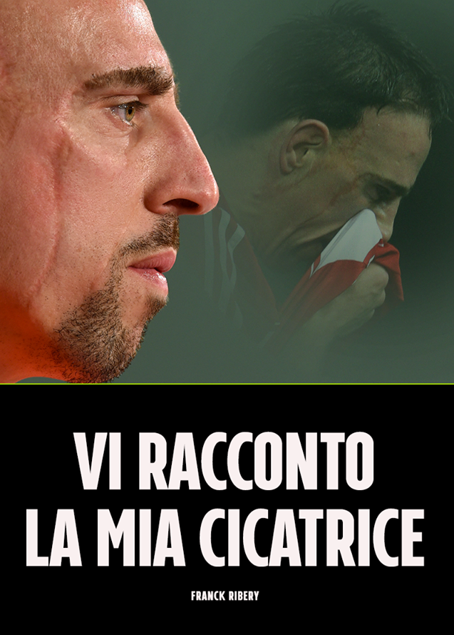 CON LE LACRIME AGLI OCCHI FRANCK RIBERY RACCONTA PER LA PRIMA VOLTA IL SUO DRAMMA DELLA CICATRICE - 19/01/2018