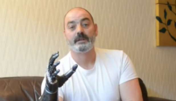 NIGEL COME 'TERMINATOR': TORNA A MUOVERSI COL BRACCIO BIONICO -VIDEO - 07/11/2012