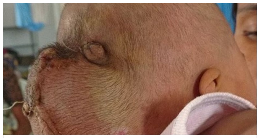 UNA 'SECONDA TESTA' ATTACCATA AL CRANIO DEL BAMBINO, POI LA VERITA' SHOCK - 24/04/2016