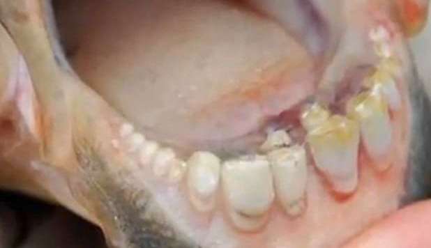 IL PESCE CON I DENTI 'UMANI' CHE AZZANNA I TESTICOLI - 10/07/2012