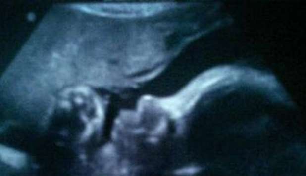LA GIOIA DI CAVANI SU TWITTER, IL BOMBER MOSTRA L'ECOGRAFIA DEL FIGLIO - FOTO - 26/01/2013