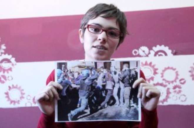 MARTINA, SFIGURATA DA UNA MANGANELLATA: POLIZIOTTO CONDANNATO. ''GIUSTIZIA È FATTA'' - FOTO - 17/05/2013
