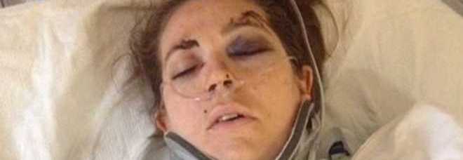 INCINTA DI 9 MESI, VIENE PICCHIATA MENTRE È ​IN VIDEOCALL COL MARITO: LUI VEDE TUTTO E LA SALVA - FOTO - 03/11/2013