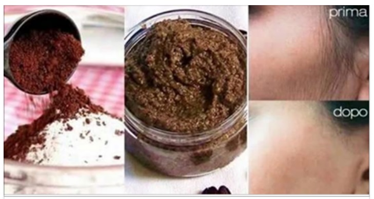 CAFFE' E BICARBONATO INSIEME PER ELIMINARE I PELI SUPERFLUI IN MODO NATURALE - 01/11/2017