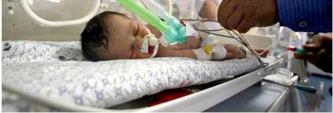 MIRACOLO TRA LE BOMBE, BIMBA ESTRATTA VIVA DAL GREMBO DELLA MADRE MORTA - 29/07/2014