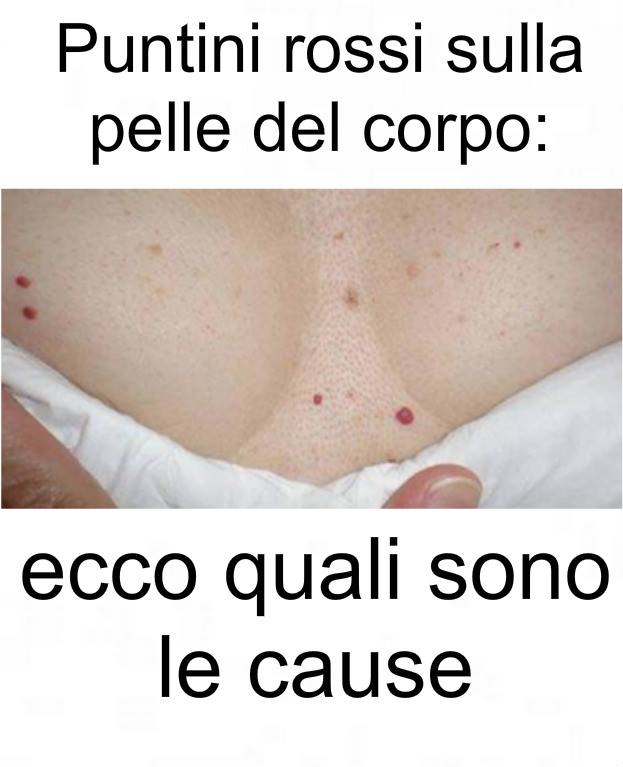 HAI QUESTI PUNTI ROSSI SULLA PELLE E SUL TUO CORPO? GLI ESPERTI: ''SI FORMANO A CAUSA DI PROBLEMI... - 02/11/2017