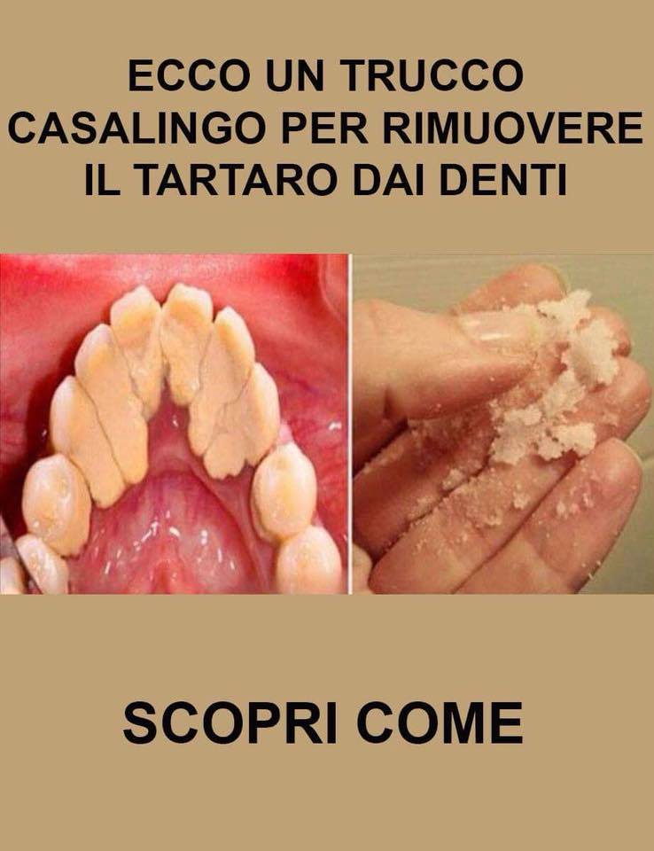 ECCO IL TRUCCO CASALINGO PER RIMUOVERE IL TARTARO DAI DENTI - 05/11/2017
