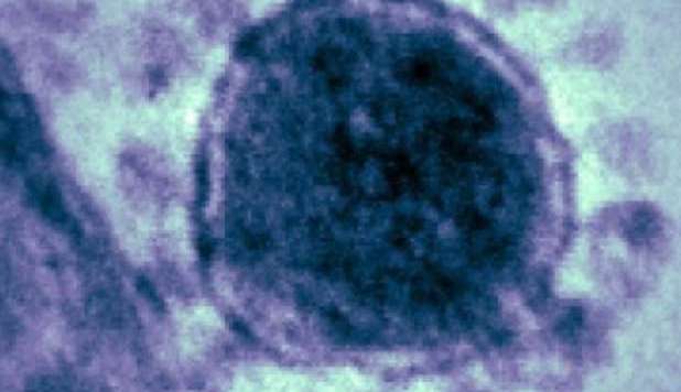 TERRORE PER UN VIRUS LETALE: 'RISCHIO EPIDEMIA, COME SARS' - 27/02/2013