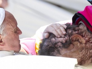 PAPA FRANCESCO BACIA UN UOMO GRAVEMENTE AMMALATO - LA FOTO FA IL GIRO DEL WEB - FOTO ALL'INTERNO - 07/11/2013