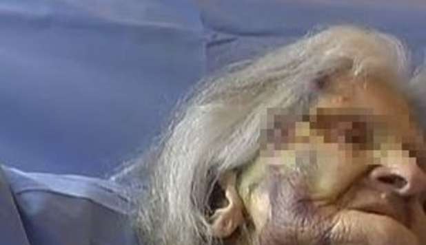 DONNA DI 80 ANNI MASSACRATA DI BOTTE MUORE IN OSPIZIO: ANZIANO E MEDICI INDAGATI - 23/03/2013