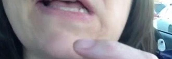 FILMA I SINTOMI DELL'ICTUS IN CORSO: IN OSPEDALE LE AVEVANO DETTO CHE ERA SOLO STRESS - VIDEO - 19/06/2014
