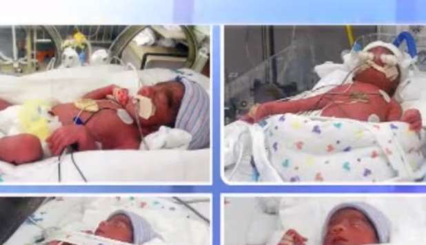 DÀ ALLA LUCE QUATTRO GEMELLI IDENTICI IN UN GIORNO: 'EVENTO RARISSIMO' - VIDEO - 19/02/2013