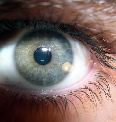 Er significato del colore degli occhi: GRIGI - 10/04/2012