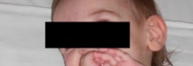 NOEMI, 15 MESI, STA MORENDO DI ATROFIA: ''I GIUDICI HANNO DETTO 'NO' A STAMINA'' - 12/09/2013