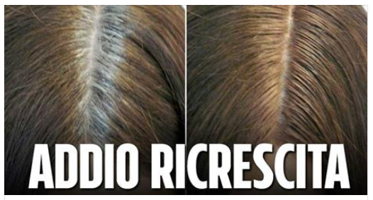 RICRESCITA ADDIO: ECCO COME NASCONDERLA - FOTO - 29/10/2015
