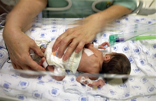Neonata, dopo le cure per la leucemia, guarisce anche dalla sindrome di Down - 24/07/2013