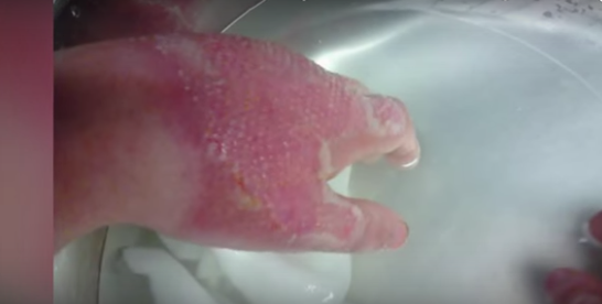 ALLARME ASL IN ITALIA: ''NON ROCCATE QUESTA PIANTA, PROVOCA CECITA' E USTIONI''. ECCO LE REGIONI COLPITE - 03/08/2015