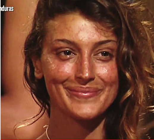 DANNI IRREPARABILI PER CRISTINA BUCCINO? IL SUO VOLTO E' DETURPATO. LA DICHIARAZIONE DEL MEDICO E' PREOCCUPANTE - 24/03/2015