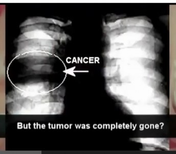 Tumori trovata la molecola che spinge al suicidio le cellule malate - 18/07/2013