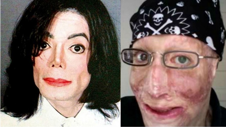 MICHAEL JACKSON E' VIVO: ''SI NASCONDE DIETRO L'IDENTITA' DI UN SUO AMICO USTIONATO'' - I 5 INDIZI CHE LO CONFERMANO - 02/11/2016