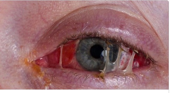 10 COSE DISGUSTOSE CHE POTREBBERO ACCADERE SE NON TI FAI LA DOCCIA - RESTERETE INORRIDITI - 16/06/2016