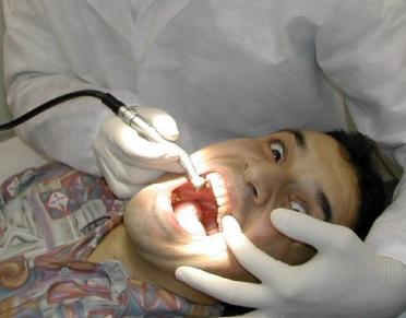 MOLLA LA FIDANZATA DENTISTA, LEI GLI STACCA TUTTI I DENTI - 26/06/2014