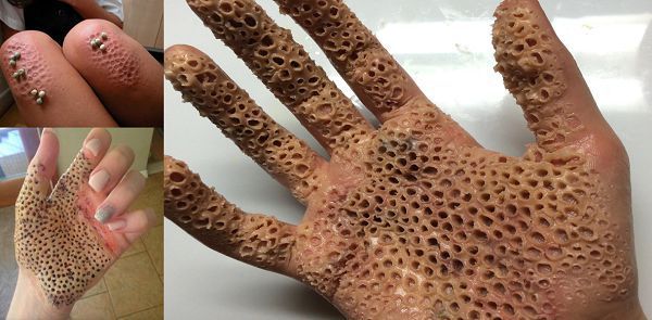 ATTENZIONE A QUESTO PRODOTTO: PUO' RIDURVI IN QUESTO STATO - CONTROLLATE IN CASA - 26/11/2016