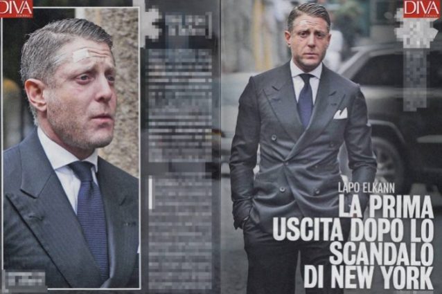 CEROTTI SULLA FRONTE, OCCHIAIE VIOLA E SGUARDO MESTO: ECCO COS'E' SUCCESSO A LAPO ELKAN - 04/01/2017