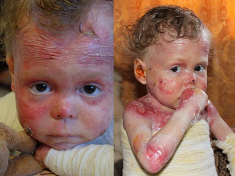 LA TRISTE STORIA DEL BIMBO CHE NON PUÒ ESSERE ACCAREZZATO - FOTO - 14/05/2013