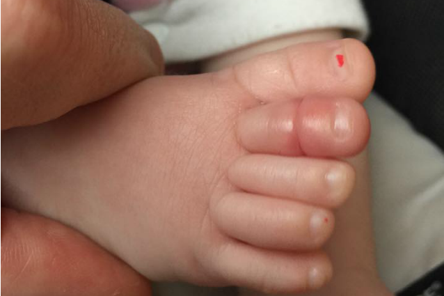NOTA UNA STRANEZZA NEL PIEDE DELLA FIGLIA, POI LA STRANA SCOPERTA - 04/02/2016